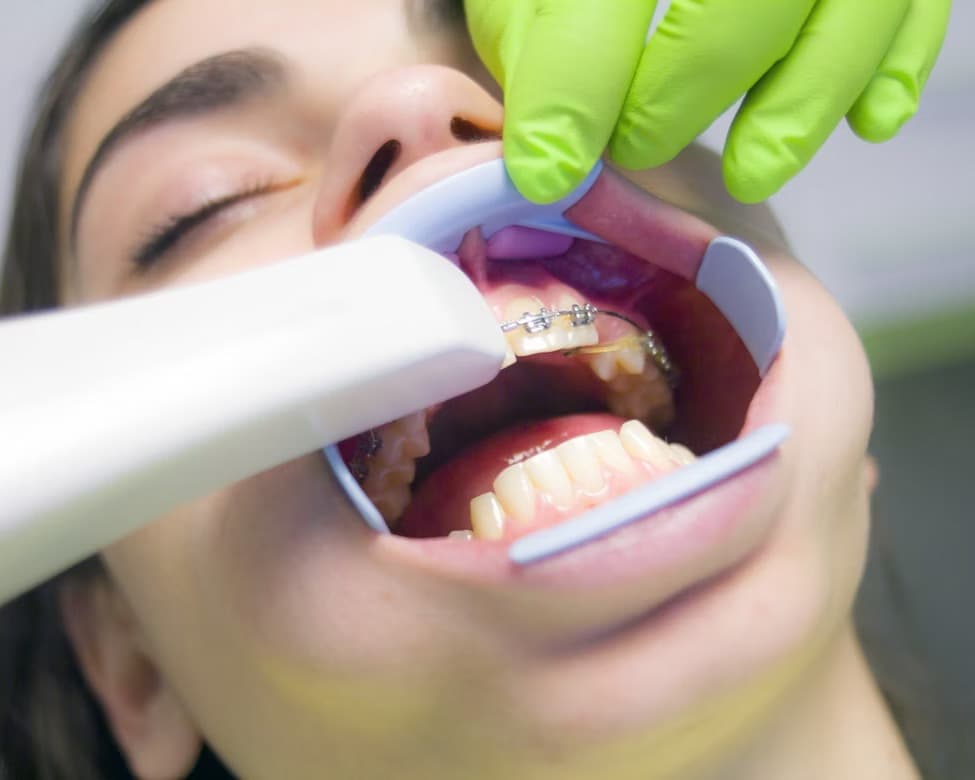 Course Dental Scanner